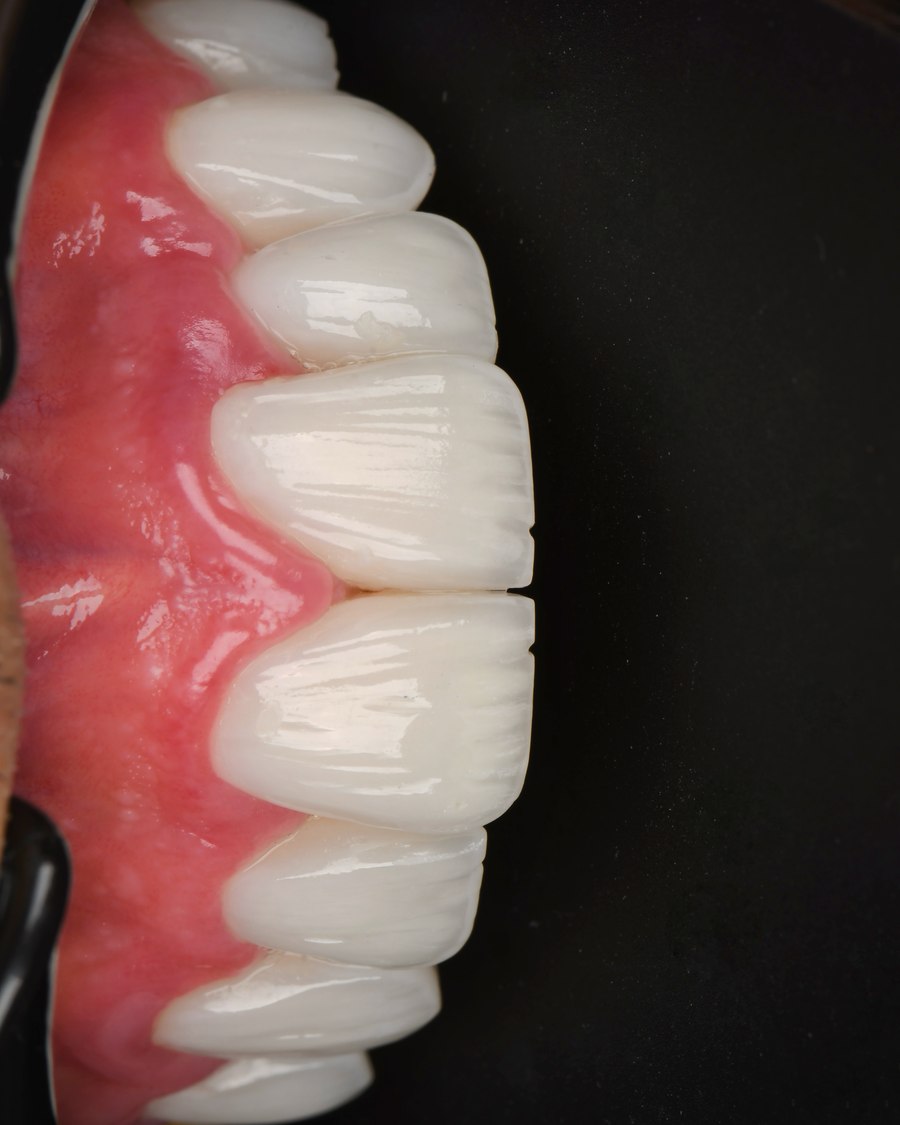 طراحی لبخند — بعد